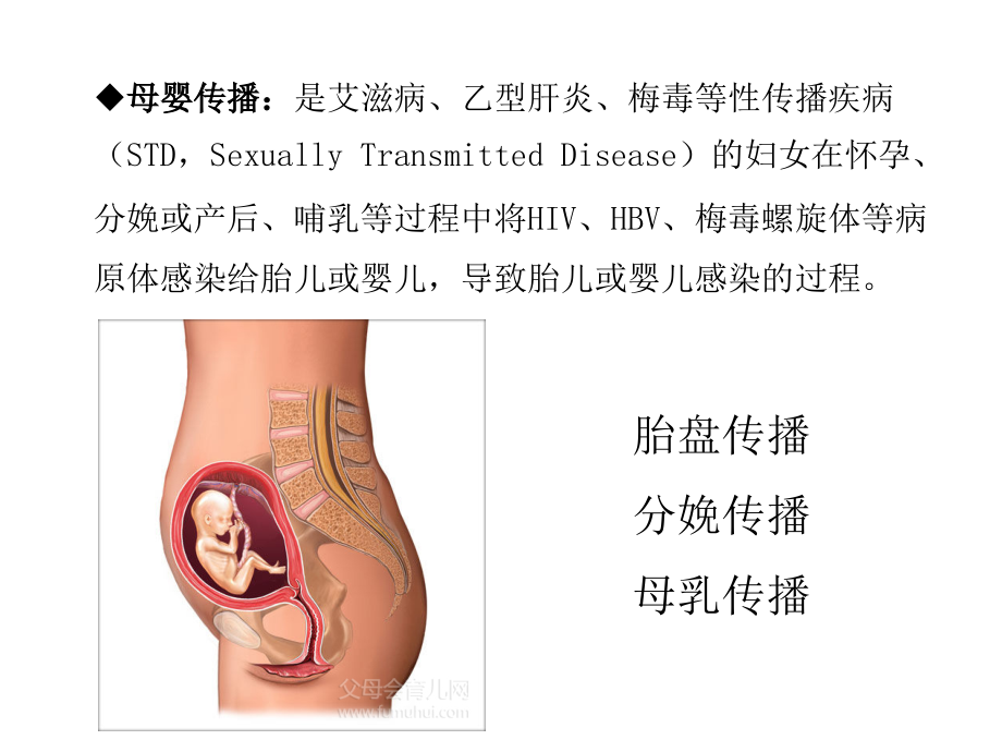 母婴垂直传播疾病课件_第3页