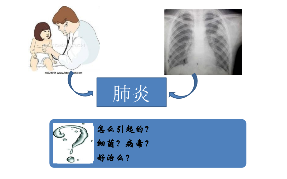 cap病例分析临床诊治的思考课件_第2页