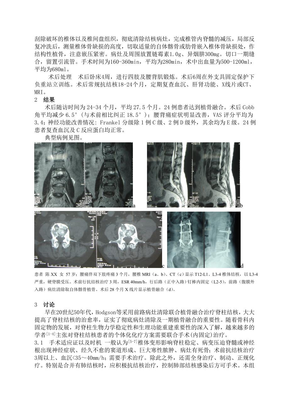 胸腰椎结核手术治疗的临床疗效观察_第2页