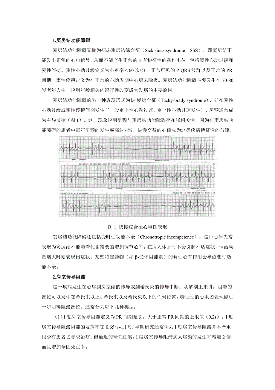 急诊缓慢性心律失常的诊断与处理_第2页