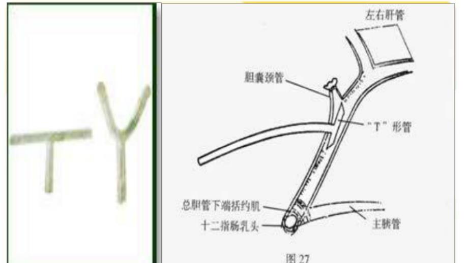 t管临床造影及临床_第2页