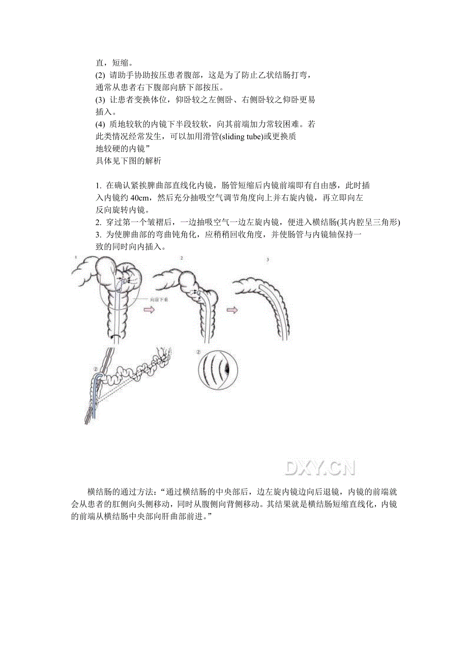 单人肠镜初学者的操作体会交流_第3页