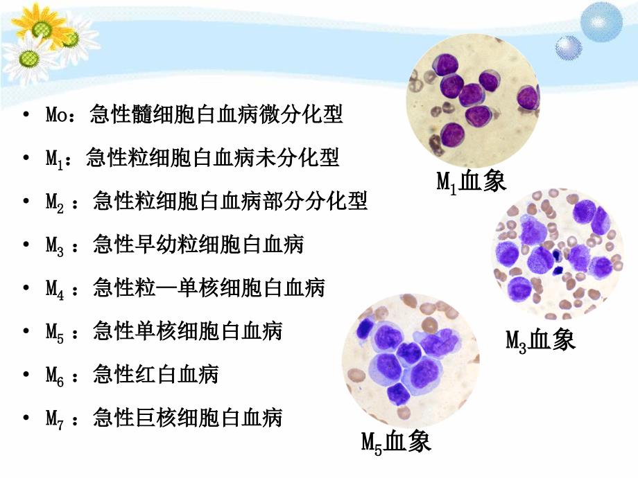 急性白血病护理查房_第4页