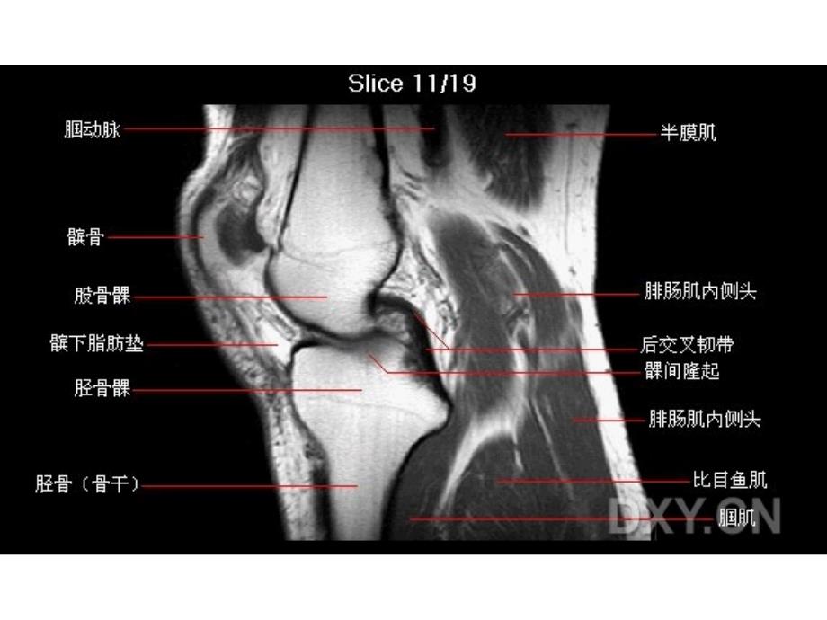 膝部MRI解剖基础医学课件_第1页