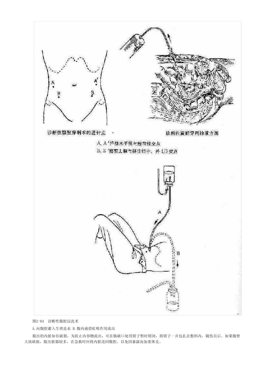 普通外科手术-腹部创伤讲座_第4页