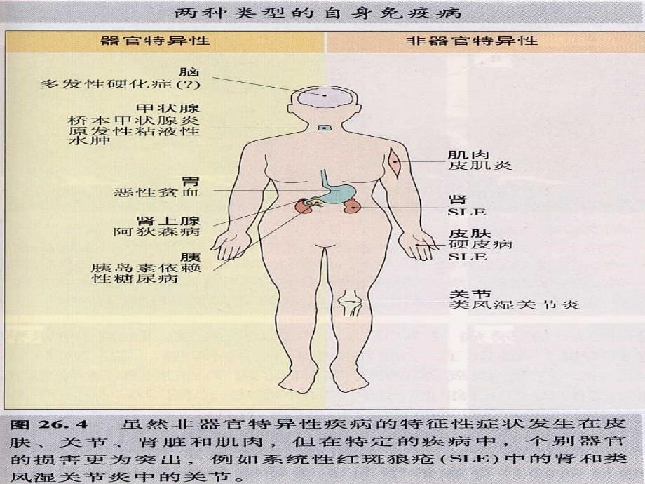 自身免疫医学课件_第5页