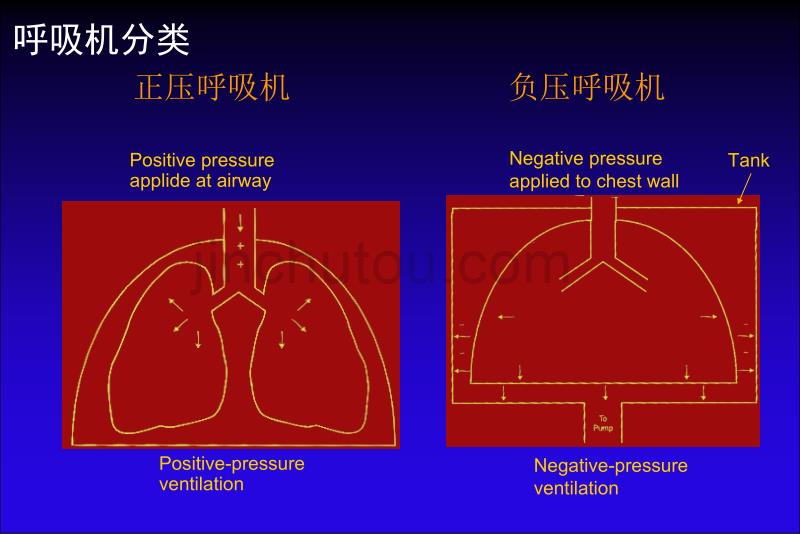 机械通气临床应用_第5页