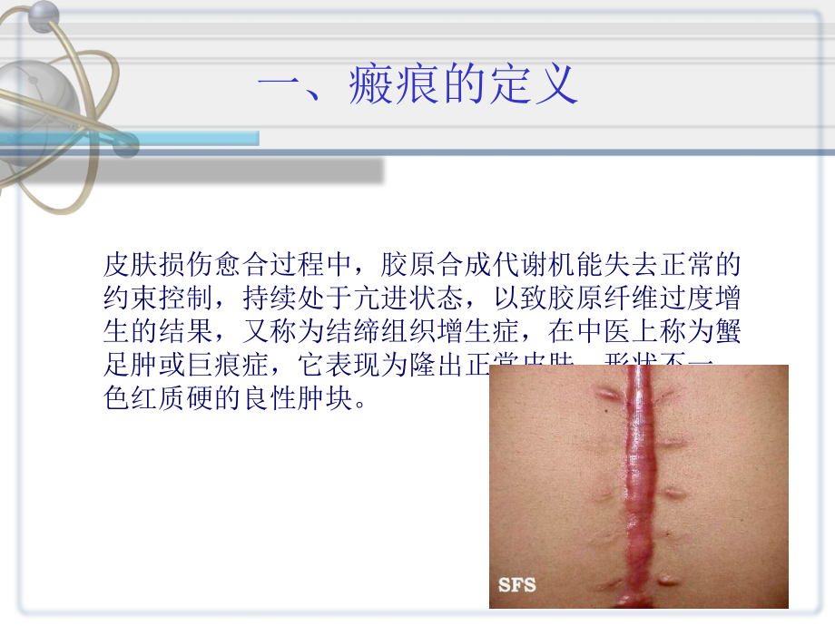 瘢痕的国内外研究进展进度课件_第4页