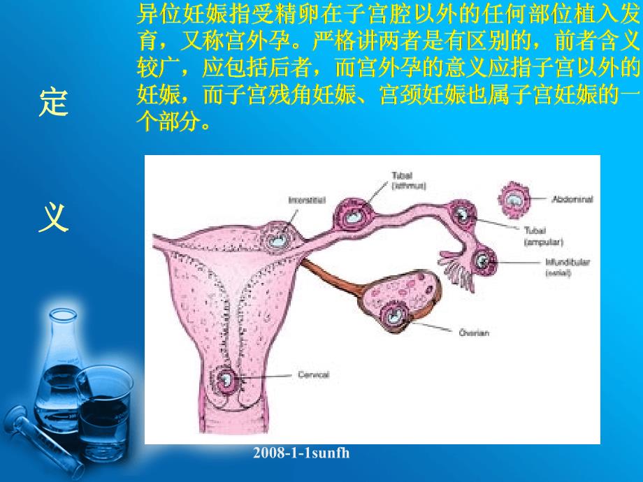 输卵管妊娠与妊娠黄体的超声鉴别诊断_第3页