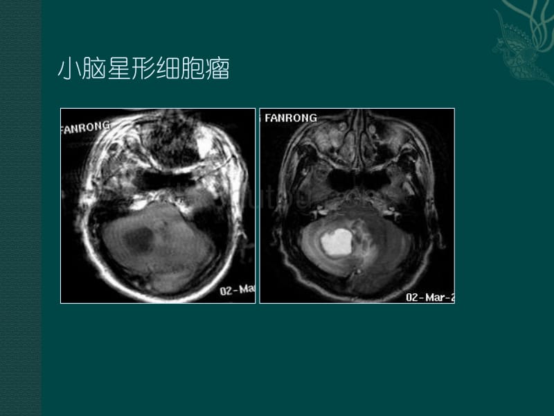 磁共振成像读片题_第3页