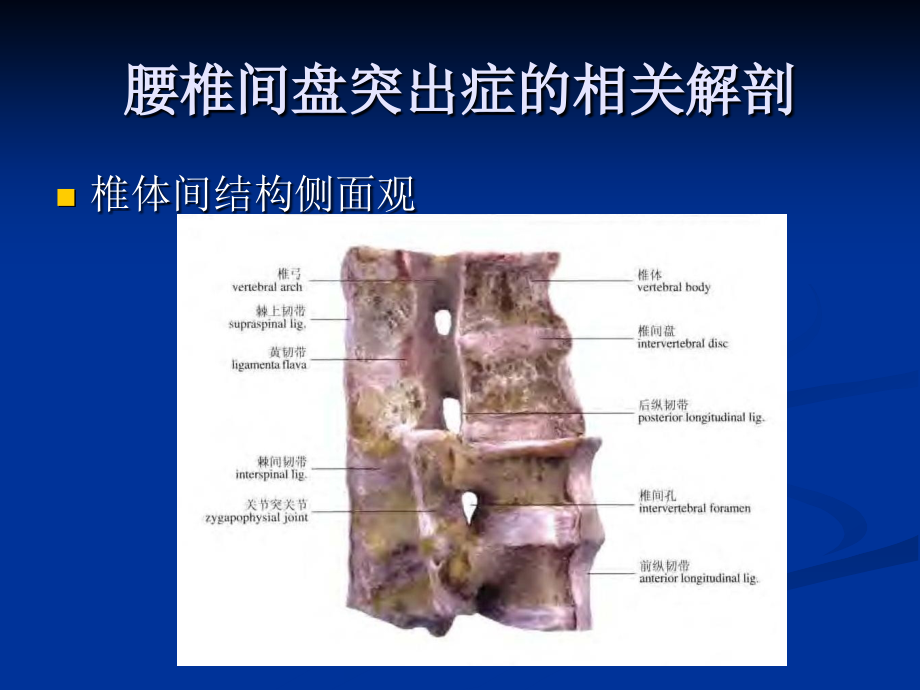 腰椎间盘突出症的诊断、鉴别诊断与分型_第4页