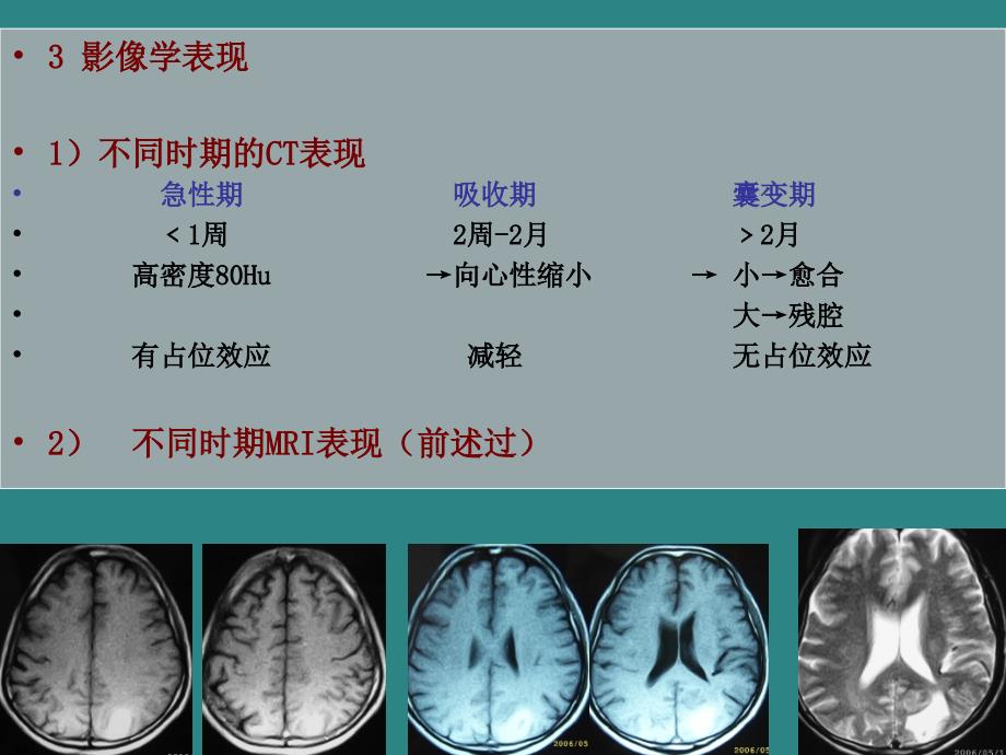 颅内出血CT、MRI诊断_第4页