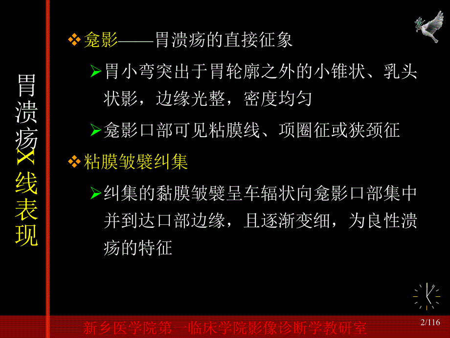 胃十二指肠溃疡影像表现_第2页