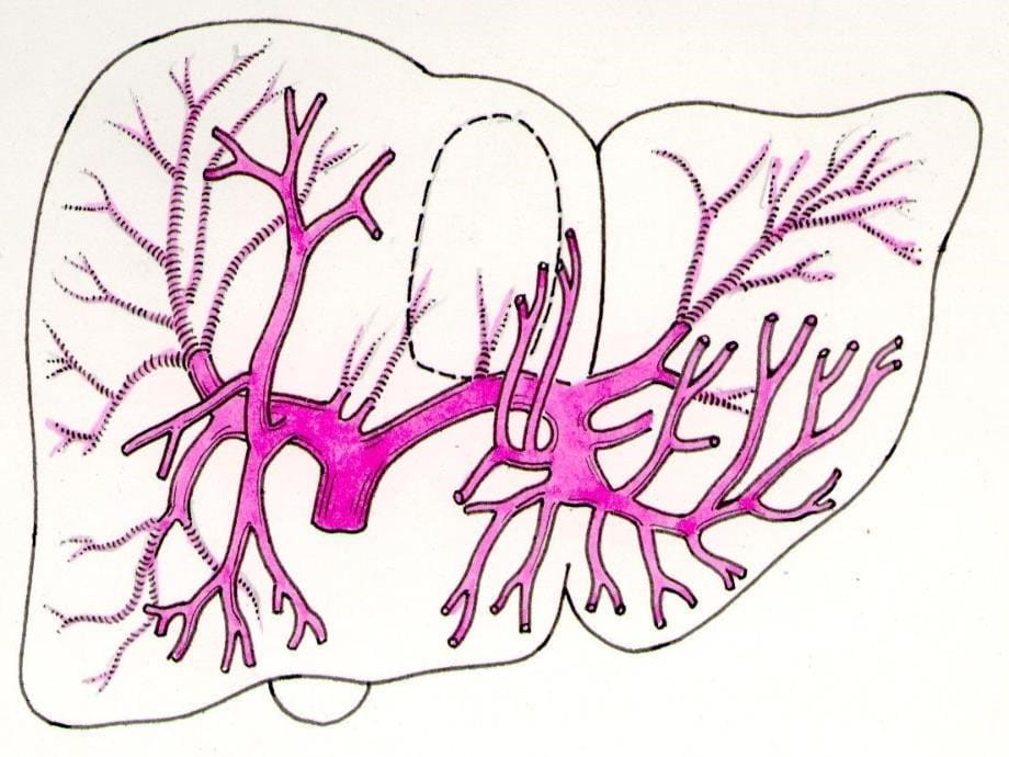 肝内管道和肝段断层解剖_第5页