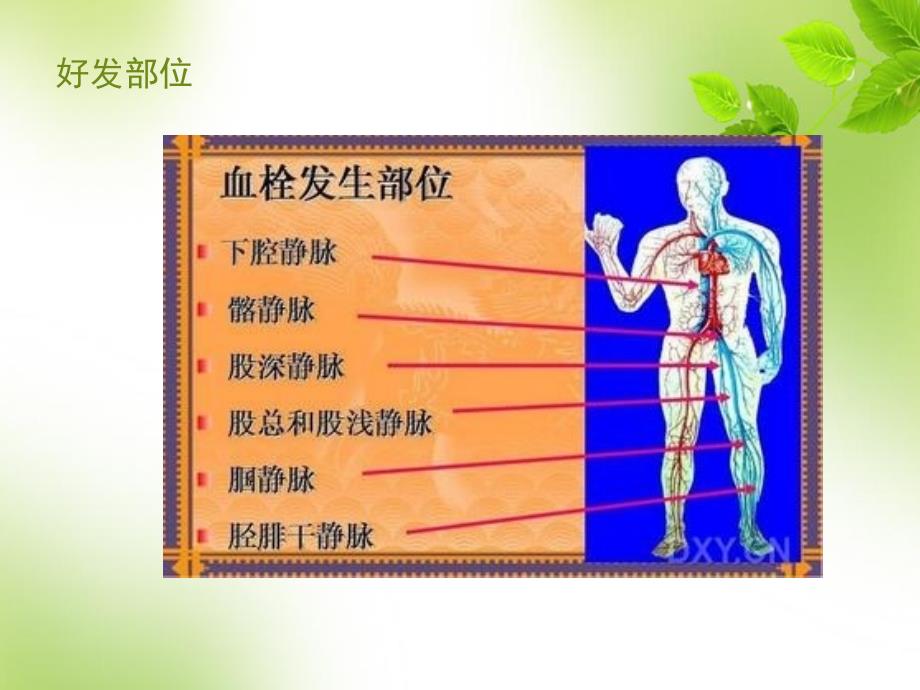 icu患者深静脉血栓形成预防指南_第4页