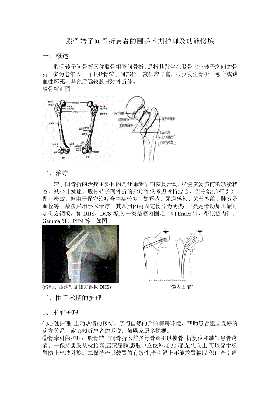 股骨转子间骨折患者的围手术期护理及功能锻炼_第1页