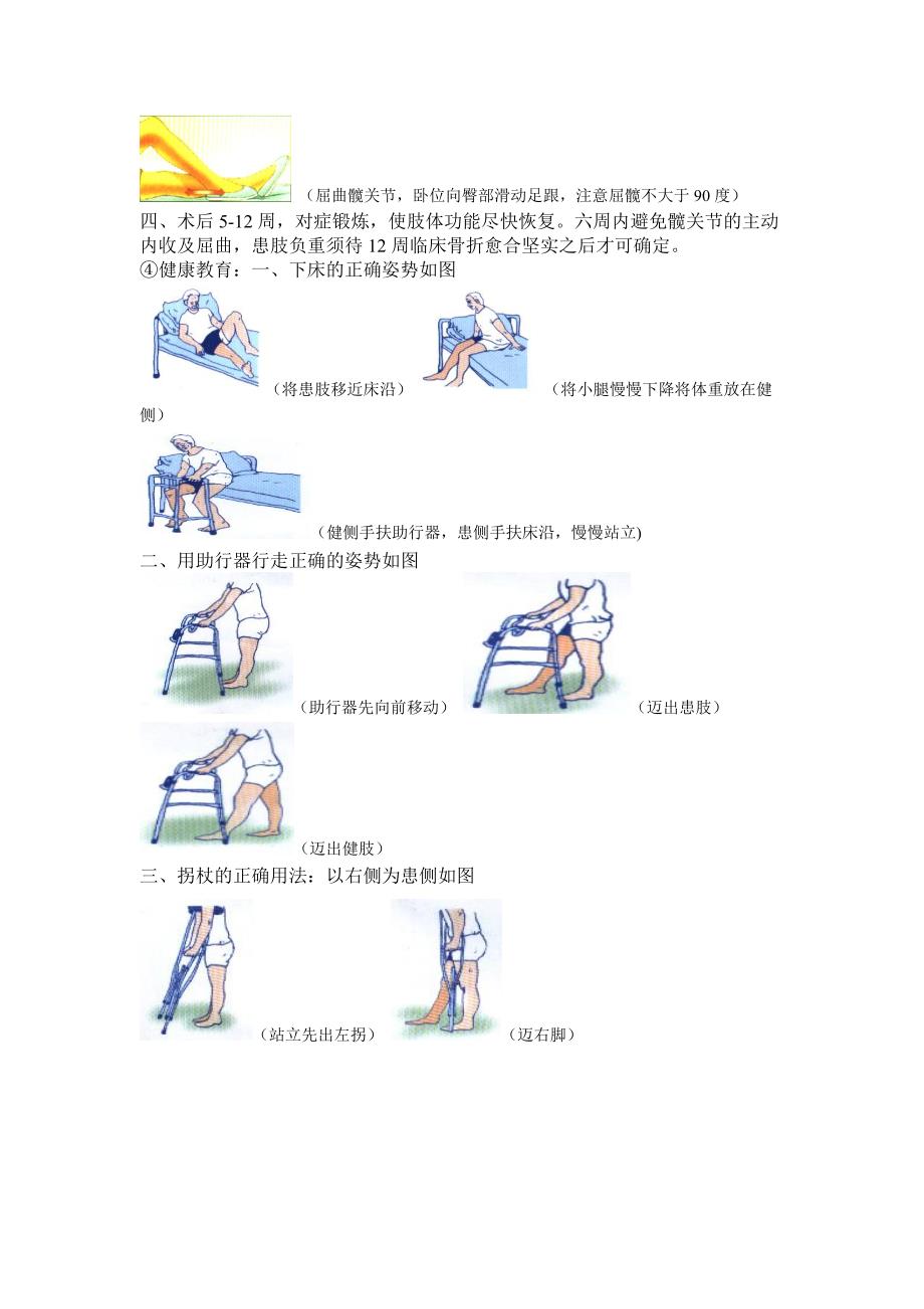 股骨转子间骨折患者的围手术期护理及功能锻炼_第3页