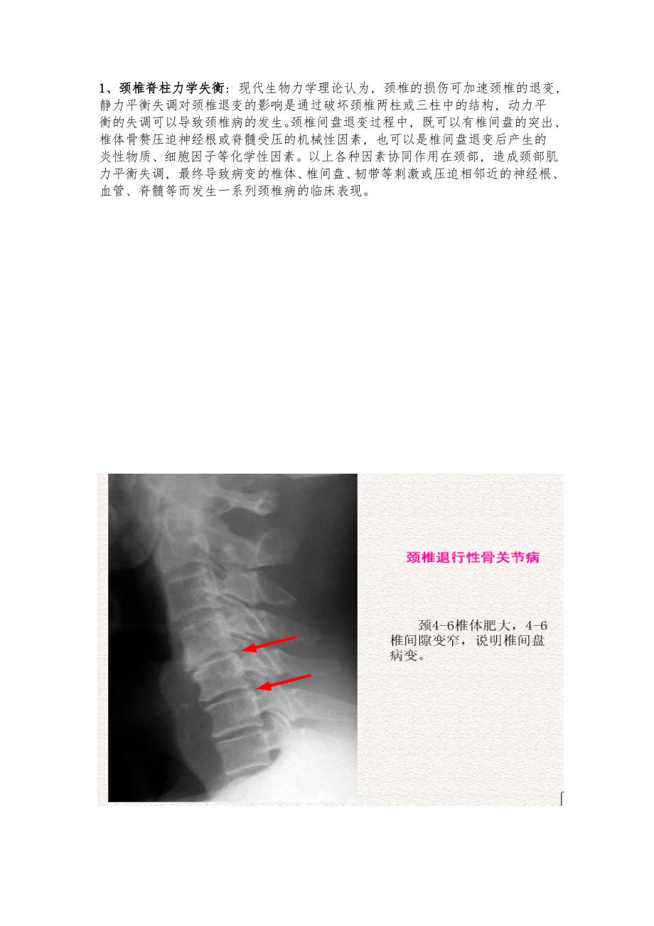 颈椎病研究报告_第3页
