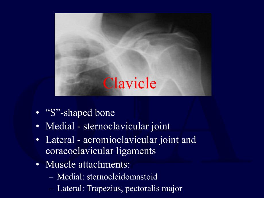 锁骨骨折课件_第2页