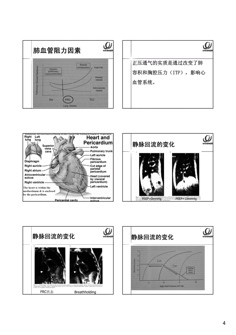 正压通气的血流动力学影响_第4页