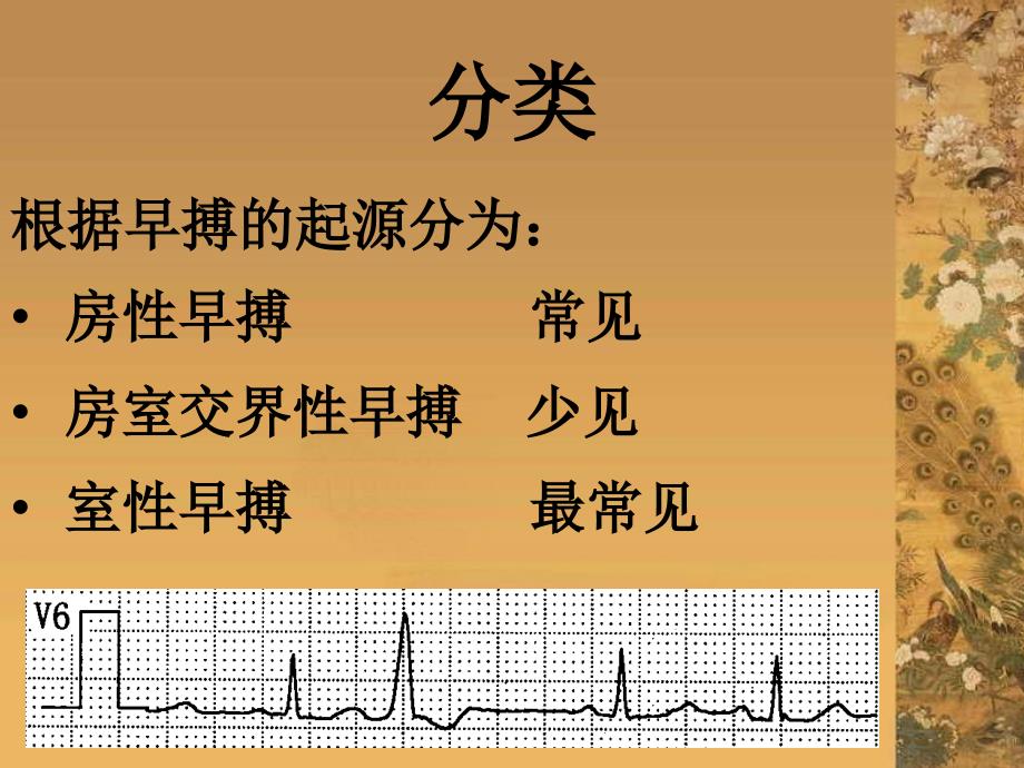 针刺调心安神法治疗早搏_第3页