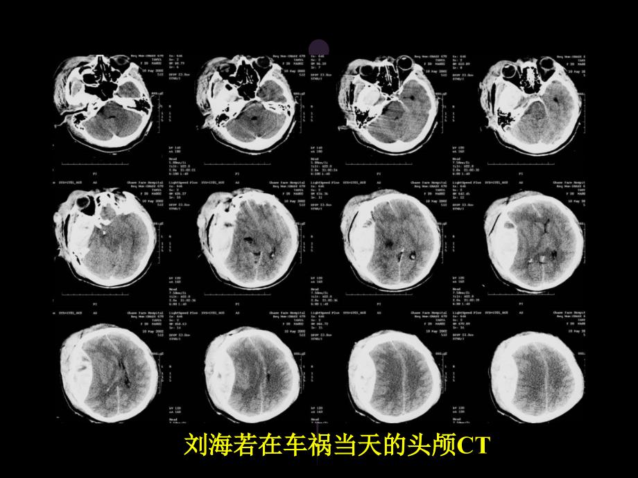 全科医师康复医学概论_第4页