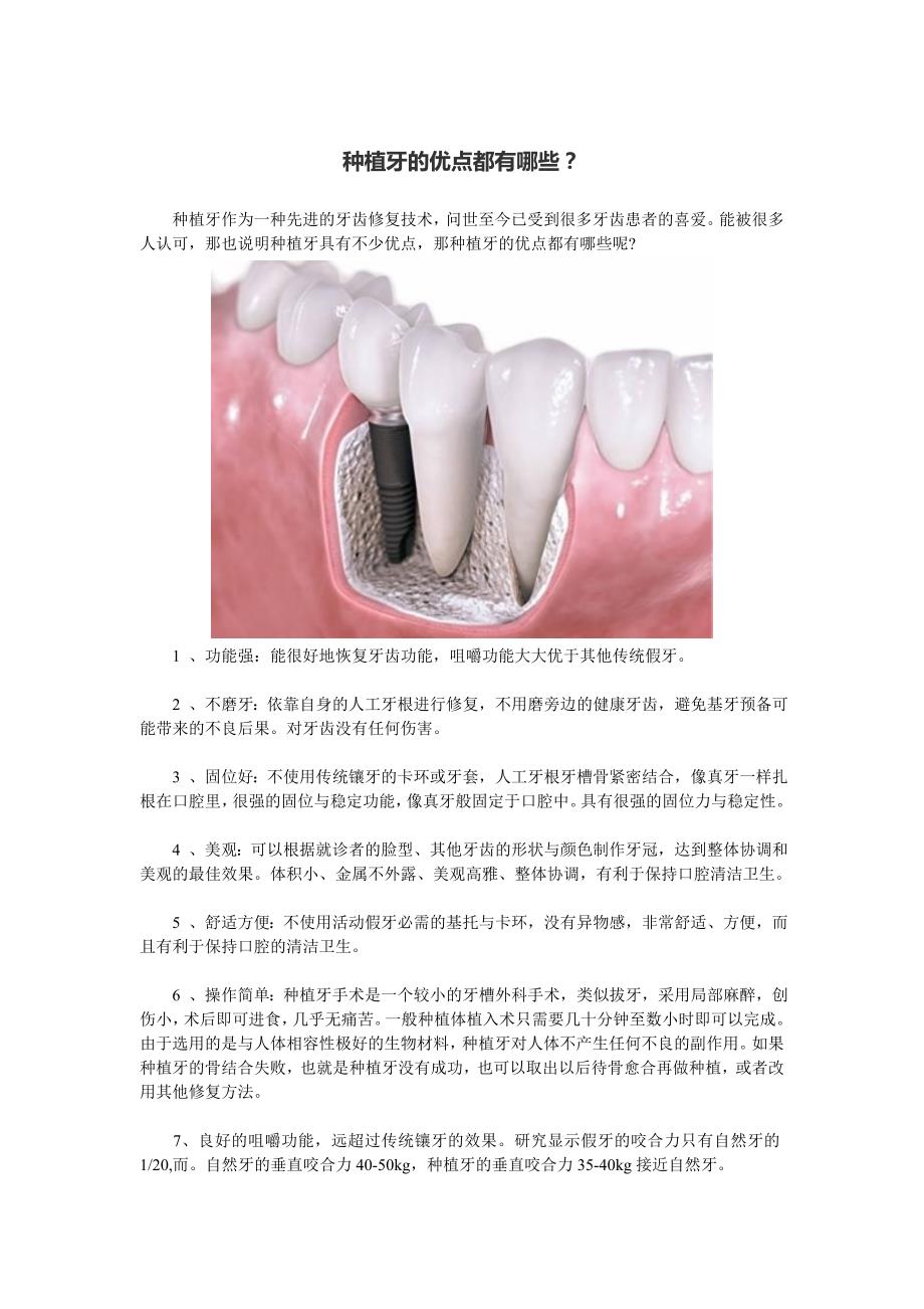 种植牙的优势有哪些？_第1页