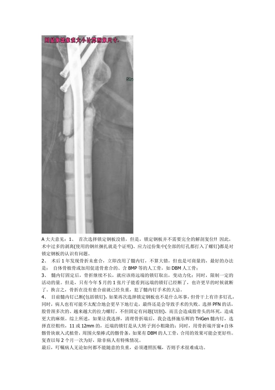 股骨粗隆下骨折骨不连的多次手术小结_第2页