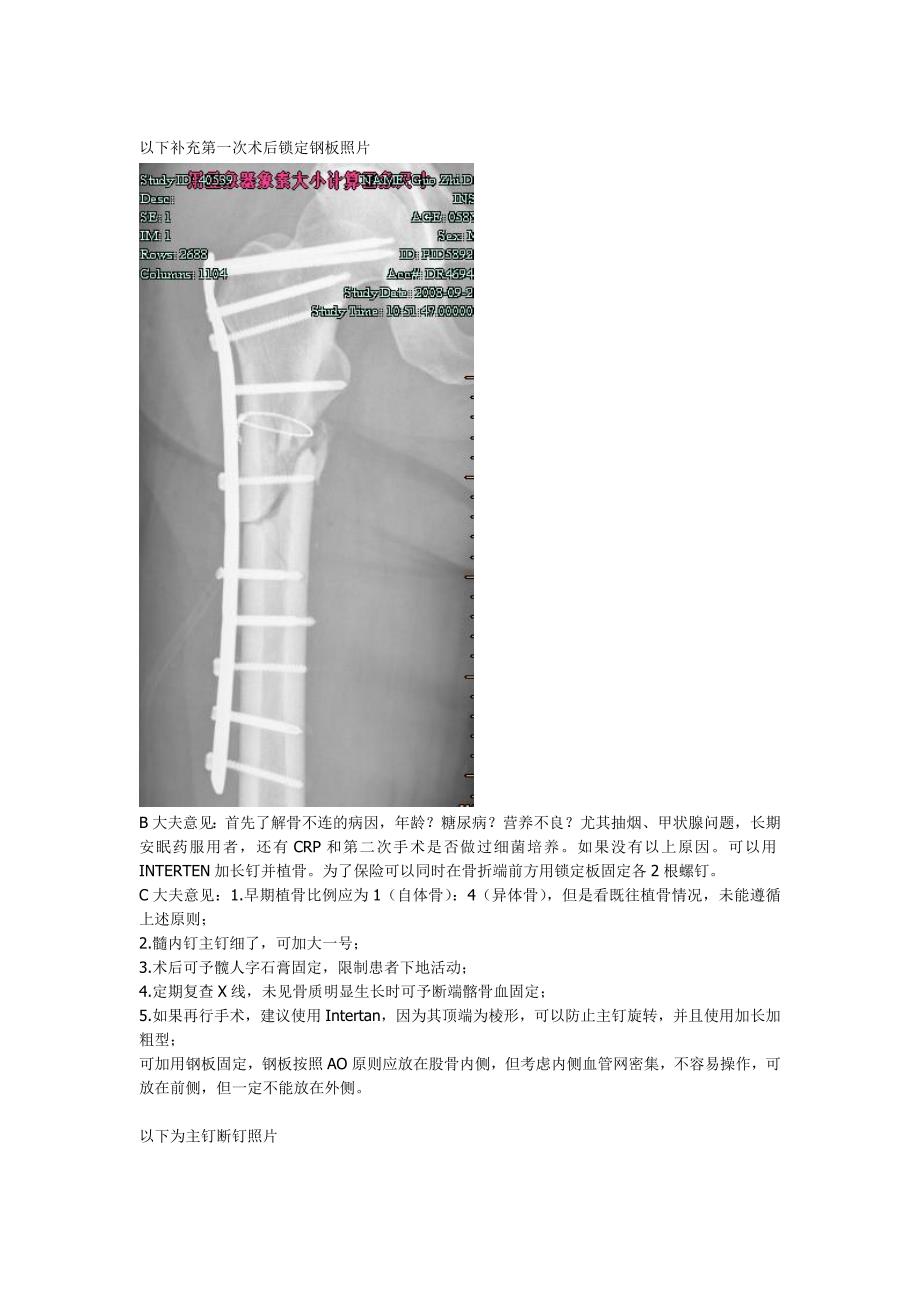 股骨粗隆下骨折骨不连的多次手术小结_第3页