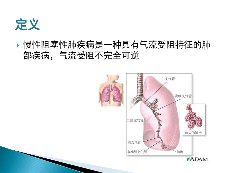 慢阻肺 课件_第3页