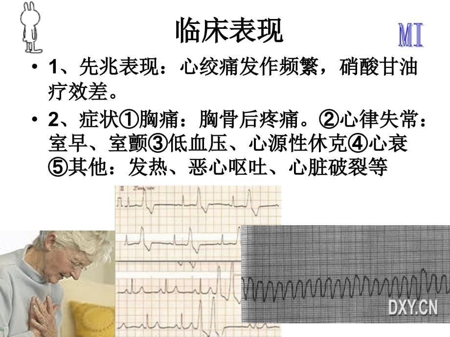 心肌梗死ppt课件_第5页