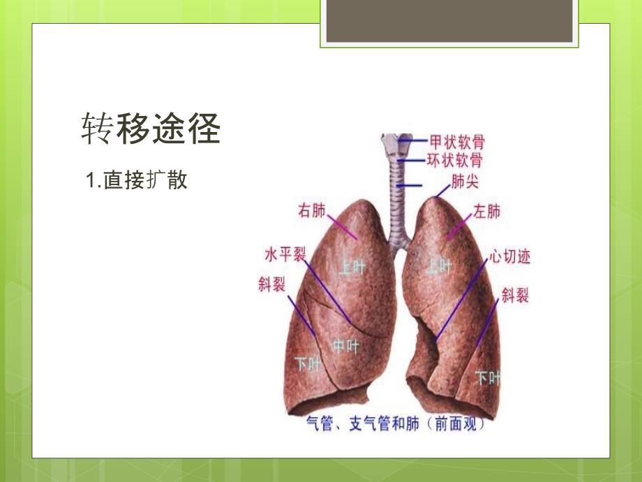 肺癌疾病病人的护理课件_第4页