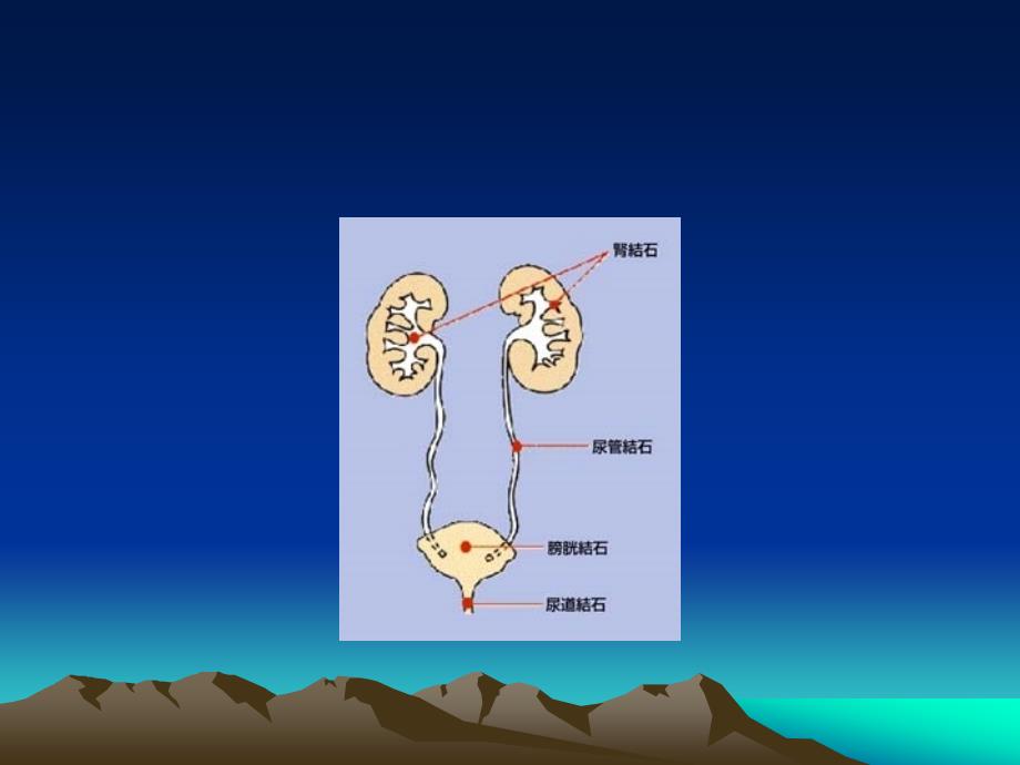 输尿管切开取石术的护理_第2页