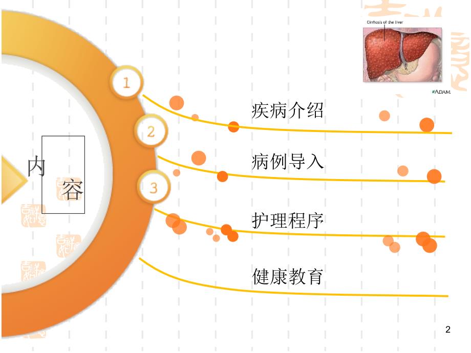 肝硬化病人的护理查房 课件_第2页