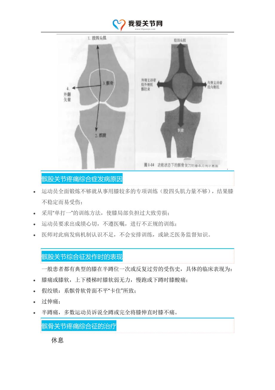 膝盖说不出哪痛,可能是髌股关节综合征_第2页