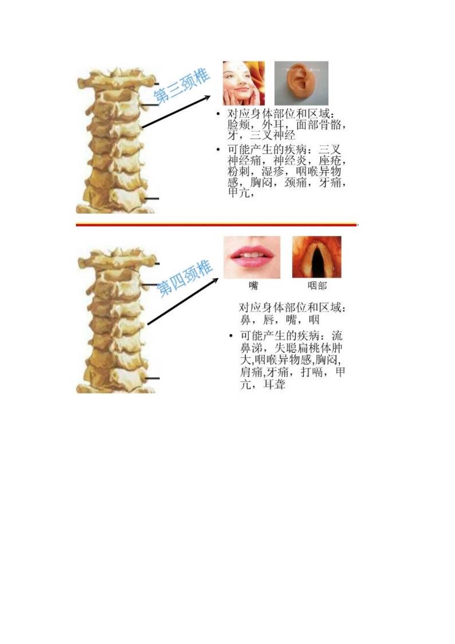 颈椎病的危害与预防_第4页