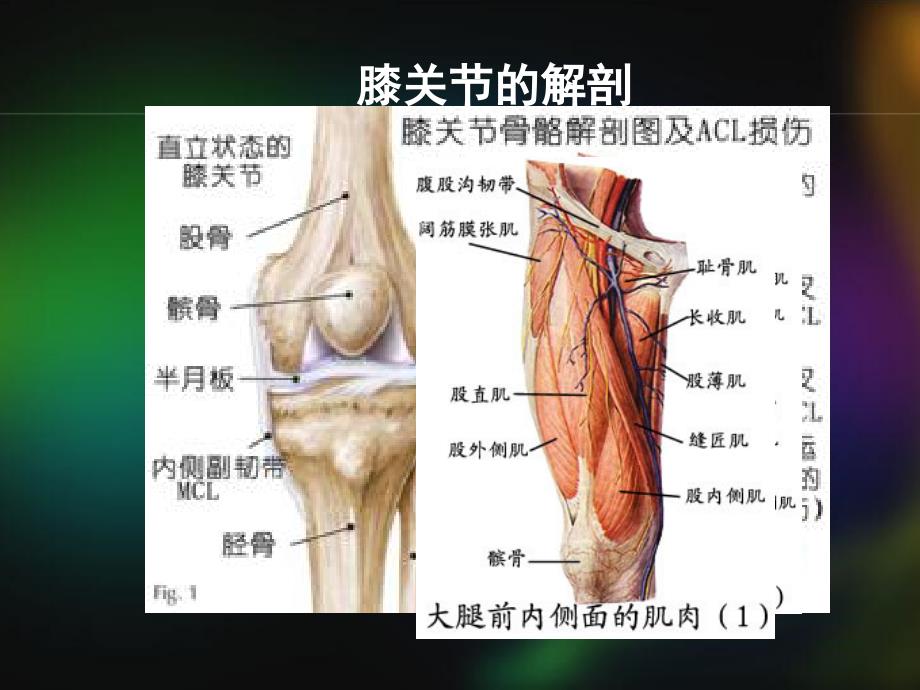 全膝置换护理 课件_第3页