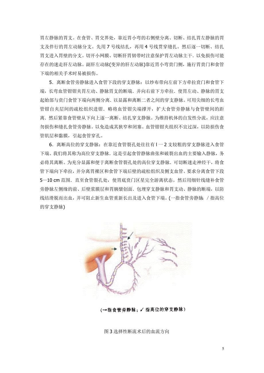 选择性贲门周围血管离断术的解剖学命名和操作步骤word_第5页