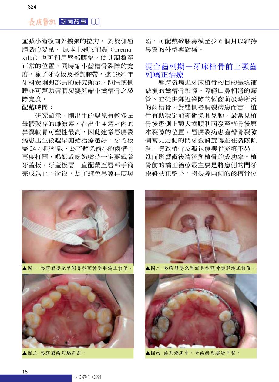 裂病患牙科治疗_第2页