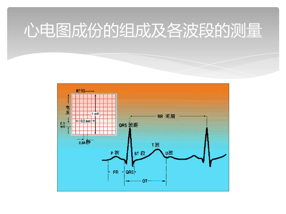 常见心电图及心肌梗死心电图的诊断_第3页