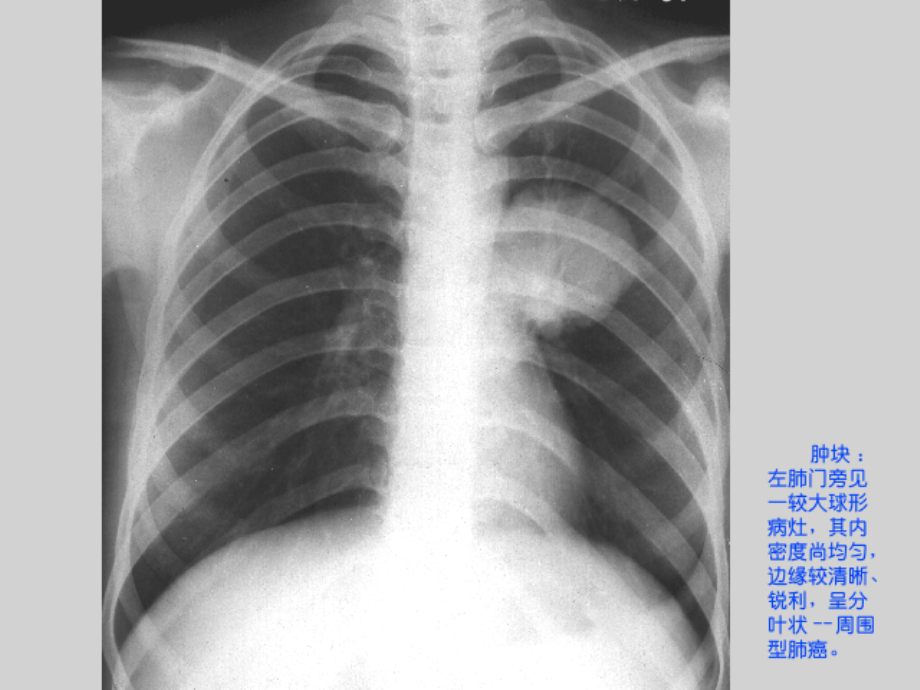 1呼吸影像诊断图X_第2页