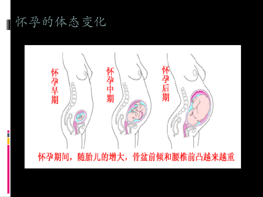 产后形体恢复指南医学PPT_第4页