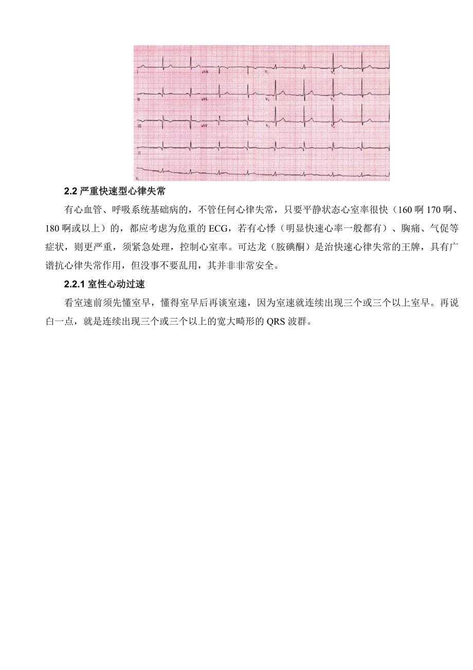 心电图基本讲解_第5页