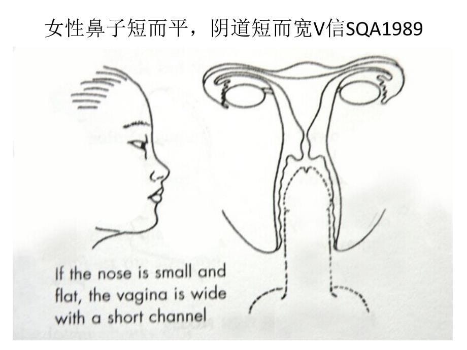 从眉毛看出阴茎大小_第5页