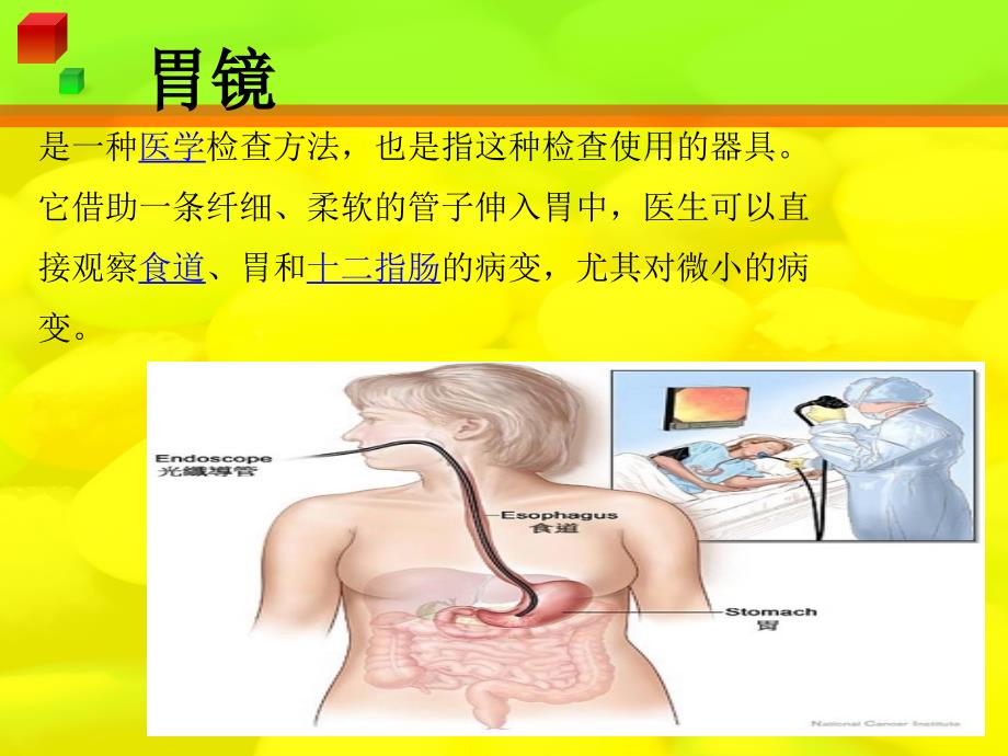 胃镜小讲课（精品PPT）_第2页