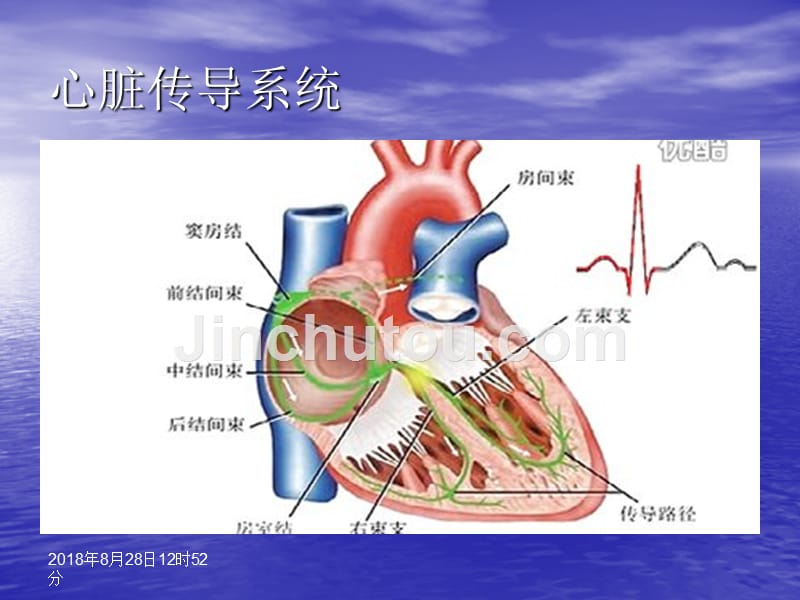 常见病心电图表现PPT课件_第3页