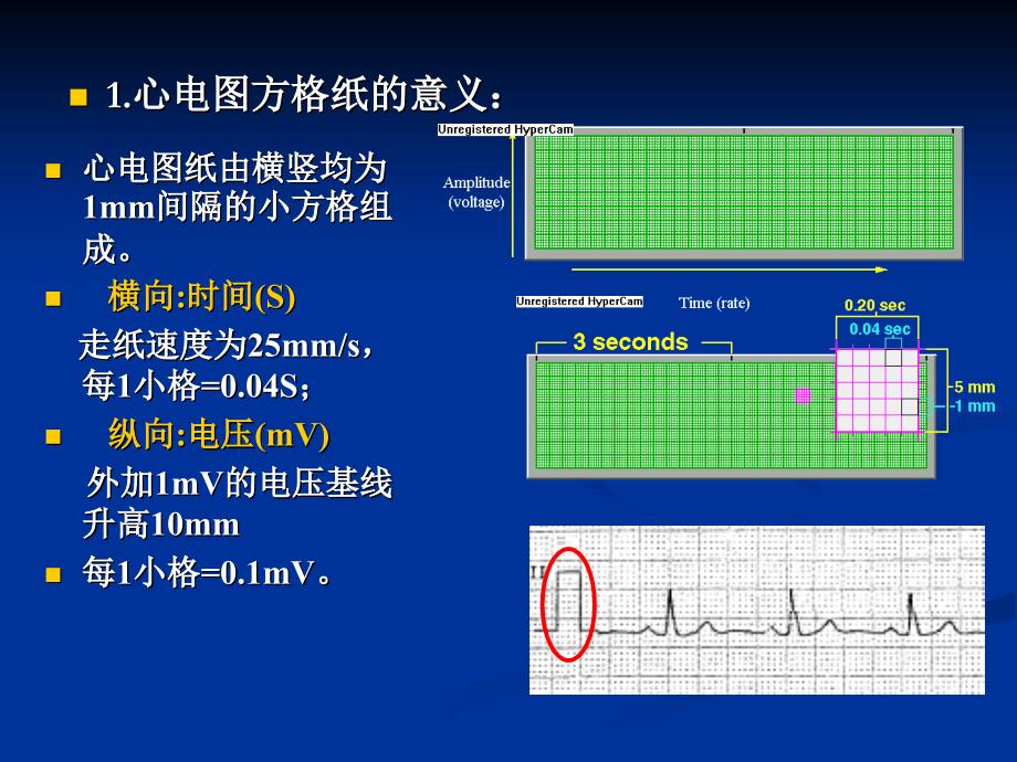 正常心电图及房室肥大（精品PPT）_第4页