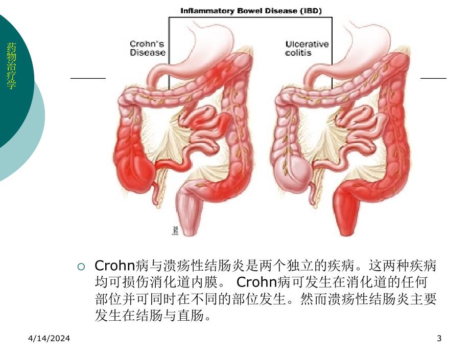 药物治疗学14_炎症性肠病_第3页