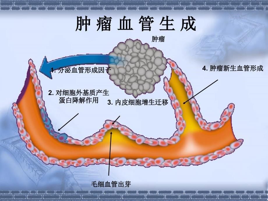 沙利度胺联合放疗治疗肺癌脑转移的疗效分析刘建刚_第5页