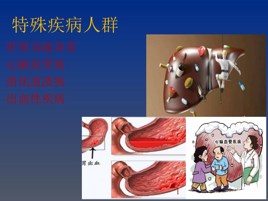 感冒用药ppt_第4页